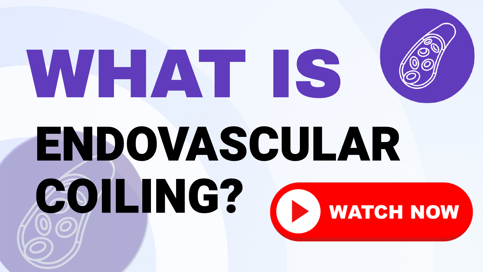 Endovascular Coiling